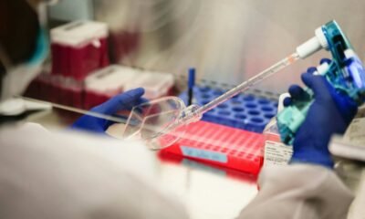 Russia Plague Scare WHO Says Epidemic Risk Is Low After Lab Worker’s Death Irkutsk Anti-Plague Research Institute Darya Shipilova